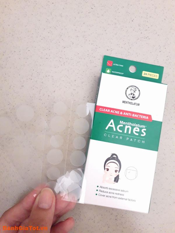 mieng-dan-mun-acnes-4