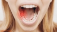8 cách trị đau răng tại nhà hiệu quả tức thì cực đơn giản