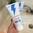 [Review] Sữa rửa mặt Zapzyt có tốt, làm sạch da mụn hiệu quả